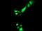 Pyrroline-5-Carboxylate Reductase 3 antibody, MA5-25320, Invitrogen Antibodies, Immunocytochemistry image 