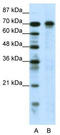Hypermethylated in cancer 1 protein antibody, TA330631, Origene, Western Blot image 