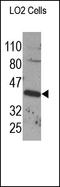 TNF Receptor Superfamily Member 11b antibody, 252182, Abbiotec, Western Blot image 