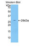 ATP Binding Cassette Subfamily G Member 1 antibody, LS-B14606, Lifespan Biosciences, Western Blot image 