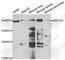Myosin-Vc antibody, A7597, ABclonal Technology, Western Blot image 