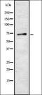 Sodium Channel Epithelial 1 Gamma Subunit antibody, orb337336, Biorbyt, Western Blot image 