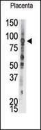 Protein Tyrosine Phosphatase Receptor Type E antibody, PA5-15525, Invitrogen Antibodies, Western Blot image 