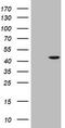 Alpha-Methylacyl-CoA Racemase antibody, TA800852, Origene, Western Blot image 