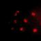 Serine/threonine-protein phosphatase 1 regulatory subunit 10 antibody, orb158183, Biorbyt, Immunofluorescence image 