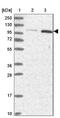 Ectonucleotide Pyrophosphatase/Phosphodiesterase 3 antibody, NBP1-88928, Novus Biologicals, Western Blot image 