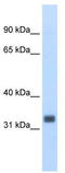ETS Homologous Factor antibody, TA345648, Origene, Western Blot image 