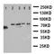 VGF Nerve Growth Factor Inducible antibody, orb97110, Biorbyt, Western Blot image 