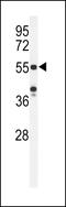 POTE Ankyrin Domain Family Member H antibody, 61-744, ProSci, Western Blot image 