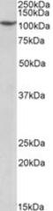 Pre-MRNA Processing Factor 6 antibody, MBS423398, MyBioSource, Western Blot image 