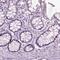 Secretogranin-1 antibody, HPA008759, Atlas Antibodies, Immunohistochemistry paraffin image 