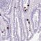 Secretin antibody, NBP2-48988, Novus Biologicals, Immunohistochemistry frozen image 