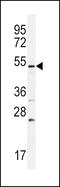Bone Morphogenetic Protein Receptor Type 1B antibody, 56-190, ProSci, Western Blot image 