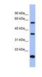 La Ribonucleoprotein Domain Family Member 6 antibody, NBP1-57460, Novus Biologicals, Western Blot image 
