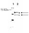 Endothelin Receptor Type B antibody, ADI-905-791-100, Enzo Life Sciences, Western Blot image 