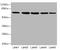IlvB Acetolactate Synthase Like antibody, orb24658, Biorbyt, Western Blot image 