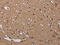 Malignant T cell-amplified sequence 1 antibody, CSB-PA200543, Cusabio, Immunohistochemistry paraffin image 