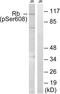 RB Transcriptional Corepressor 1 antibody, LS-C199530, Lifespan Biosciences, Western Blot image 