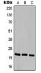 Cerebellin 1 Precursor antibody, LS-C351935, Lifespan Biosciences, Western Blot image 