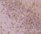 AP2M1 antibody, NBP2-67762, Novus Biologicals, Immunohistochemistry paraffin image 
