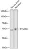 Reticulon 4 Receptor Like 1 antibody, GTX64991, GeneTex, Western Blot image 