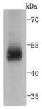 Carbonic Anhydrase 9 antibody, A01083-2, Boster Biological Technology, Western Blot image 