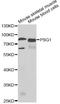 Pregnancy-specific beta-1-glycoprotein 1 antibody, A6399, ABclonal Technology, Western Blot image 