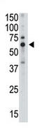 SLG antibody, AP11627PU-N, Origene, Western Blot image 