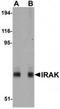 Interleukin 1 Receptor Associated Kinase 1 antibody, TA319668, Origene, Western Blot image 