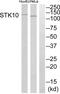 Serine/Threonine Kinase 10 antibody, abx015163, Abbexa, Western Blot image 