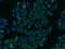 PBC antibody, 13426-1-AP, Proteintech Group, Immunofluorescence image 