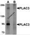 Pappalysin-2 antibody, 6019, ProSci Inc, Western Blot image 