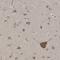 Divergent Protein Kinase Domain 1A antibody, HPA017281, Atlas Antibodies, Immunohistochemistry paraffin image 