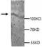 Adenylate Cyclase 6 antibody, TA310097, Origene, Western Blot image 