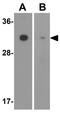 Solute Carrier Family 39 Member 2 antibody, GTX85134, GeneTex, Western Blot image 