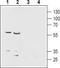 Solute Carrier Family 29 Member 1 (Augustine Blood Group) antibody, TA328695, Origene, Western Blot image 