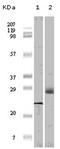 Eukaryotic Translation Initiation Factor 4E Binding Protein 1 antibody, AM06148SU-N, Origene, Western Blot image 