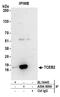 Elongin B antibody, A304-008A, Bethyl Labs, Immunoprecipitation image 