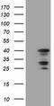 Chromosome 16 Open Reading Frame 72 antibody, TA501514S, Origene, Western Blot image 