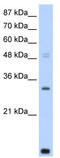CCR4-NOT Transcription Complex Subunit 7 antibody, TA343714, Origene, Western Blot image 