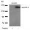Fms Related Tyrosine Kinase 4 antibody, orb227751, Biorbyt, Western Blot image 