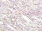 Migration And Invasion Inhibitory Protein antibody, GTX51659, GeneTex, Immunohistochemistry paraffin image 