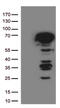 Estrogen Receptor 1 antibody, TA506414BM, Origene, Western Blot image 