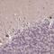 Zinc Finger Protein 709 antibody, PA5-62744, Invitrogen Antibodies, Immunohistochemistry paraffin image 