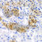 4-Hydroxyphenylpyruvate Dioxygenase antibody, A6505, ABclonal Technology, Immunohistochemistry paraffin image 
