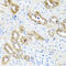 Fatty Acid Binding Protein 5 antibody, LS-C335110, Lifespan Biosciences, Immunohistochemistry paraffin image 