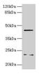 FGF1 Intracellular Binding Protein antibody, CSB-PA008671LA01HU, Cusabio, Western Blot image 