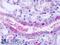 2-oxoglutarate receptor 1 antibody, LS-A1865, Lifespan Biosciences, Immunohistochemistry frozen image 