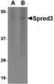 Sprouty Related EVH1 Domain Containing 3 antibody, LS-C82865, Lifespan Biosciences, Western Blot image 