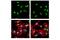 Replication Protein A2 antibody, 35869S, Cell Signaling Technology, Immunocytochemistry image 